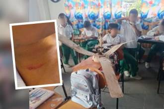Dos estudiantes resultaron levemente heridos por las aspas del artefacto. FOTOS: TELEMEDELLÍN