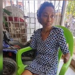 Después de mes y medio en coma despertó con manos y pies negros, lo cual hizo necesario amputar. FOTO: CAPTURA DE VIDEO EMISORA ATLÁNTICO