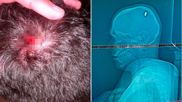 /FOTO: Q’HUBO Bucaramanga