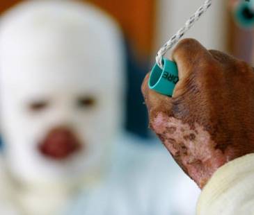 La víctima estuvo bajo observación médica por 2 semanas. FOTO: ARCHIVO EL COLOMBIANO