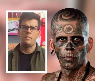 Al escuchar su historia, un especialista decidió regalarle el tratamiento láser. FOTO: INSTAGRAM @LEONARDODESOUZABLESS