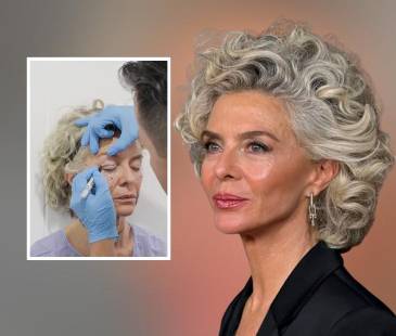 Margarita Rosa de Francisco y su rejuvenecimiento facial. @MARGARITAROSA.DEFRANCISCO IG Y @ALANGONZALEZMD IG