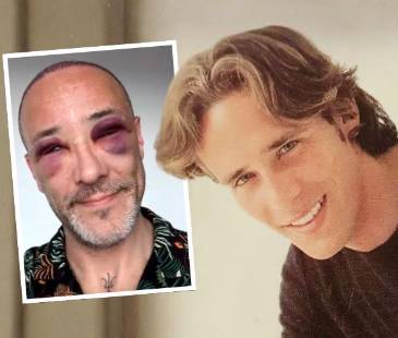 Foto principal: Ricardo Herrera cuando interpretó a JP en ‘Padres e hijos’. Detalle: el actor tras su último tratamiento capilar. FOTOS: INSTAGRAM @ricardoherreraneira