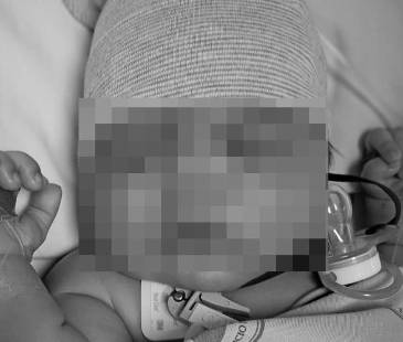 Bebé fallecido en hospital de Cartagena. FOTO: TOMADA DE FACEBOOK ALCALDÍA DE BOSCONIA