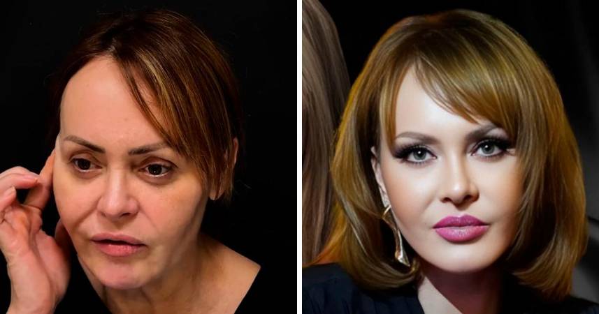 A la izquierda, como estaba antes del procedimiento. A la derecha, como quedó. FOTO: INSTAGRAM @gabyspanictv