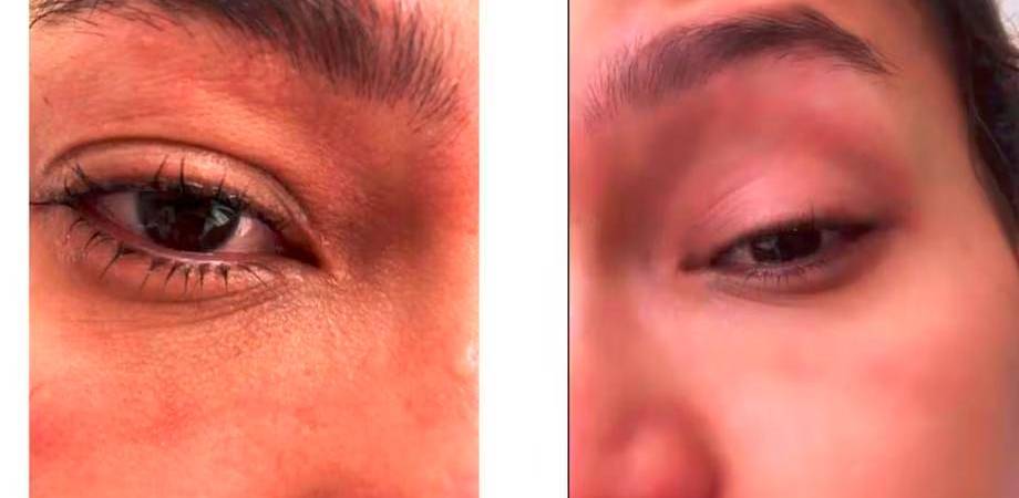 La modelo dijo que tenía rojo el ojo y que veía un poco borroso. /FOTO: CAPTURA DE PANTALLA